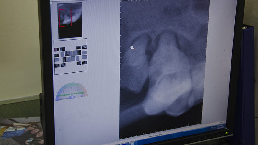 876x493 colonial Services DentalX ray