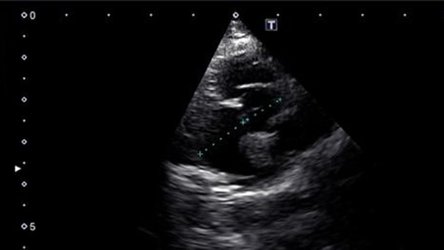 876x493 encina cardiology