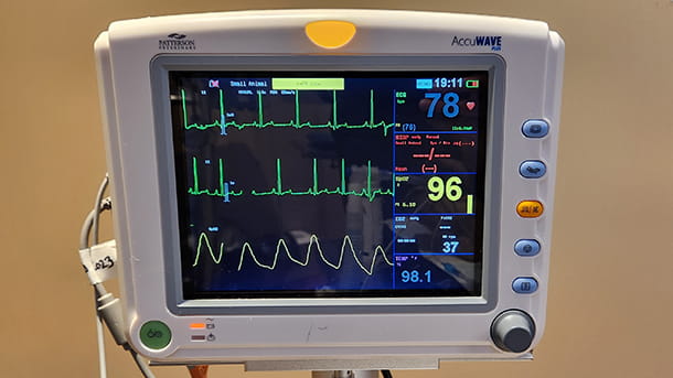 EKG machine